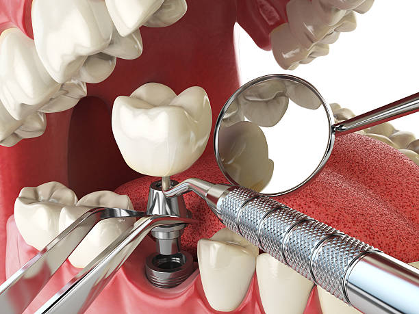 Best Emergency Care for Gum Disease in Bolivar, MO